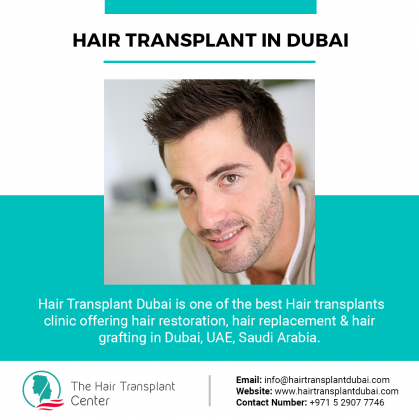 Hair transplant In Dubai