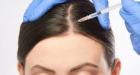 Best Hair Transplant Center in Dubai