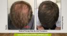 Hair Transplant Surgeon