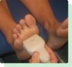 Wart On Bottom Of Foot Treatment Perth Amboy, NJ