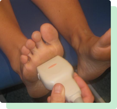 Remove Warts On Feet Perth Amboy, NJ