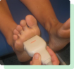 Remove Warts On Feet Perth Amboy, NJ