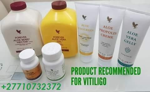 Dark Knuckle Whitening Serum In Anchorage City in Alaska Call +27710732372 Get Rid Of Vitiligo In Coleman Town in Texas, United States
