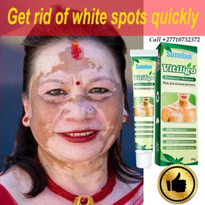 Dark Knuckle Whitening Serum In Anchorage City in Alaska Call +27710732372 Get Rid Of Vitiligo In Coleman Town in Texas, United States
