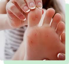 Plantar Fasciitis Heel Pain Treatment