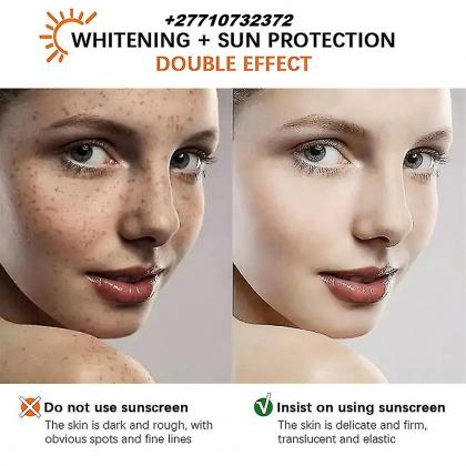 Skin Bleaching In Ketchikan City in Revillagigedo Island, Alaska Call ☏ +27710732372 Scars And Stretch Marks Removal Cream In Lockhart City in Texas