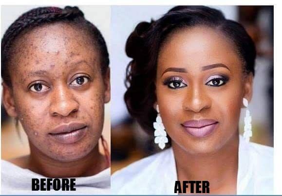 Skin Bleaching In Ketchikan City in Revillagigedo Island, Alaska Call ☏ +27710732372 Scars And Stretch Marks Removal Cream In Lockhart City in Texas