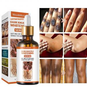 Dark Knuckle Whitening Serum In Anchorage City in Alaska Call +27710732372 Get Rid Of Vitiligo In Co